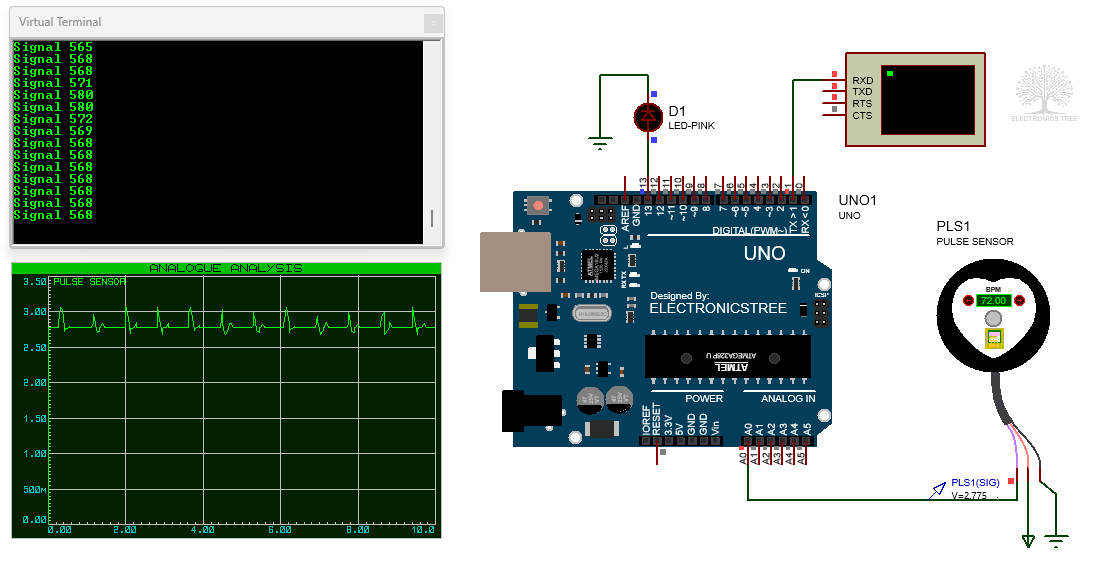 Pulse Sensor with Arduino - Proteus Simulation